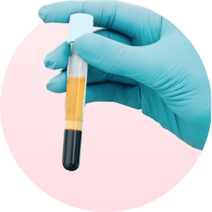 ภาพ PPP Autologous Serum มือถือ