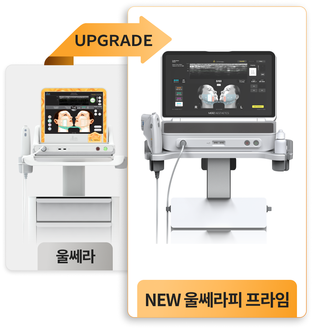 ภาพบนมือถือตัวเครื่อง Ultherapy Prime รุ่นอัปเกรด
