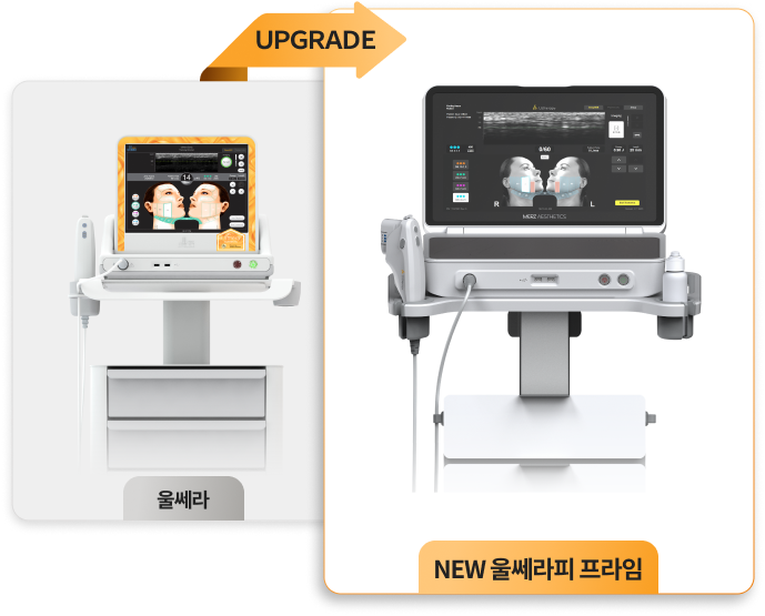 ภาพตัวเครื่อง Ultherapy Prime รุ่นอัปเกรด