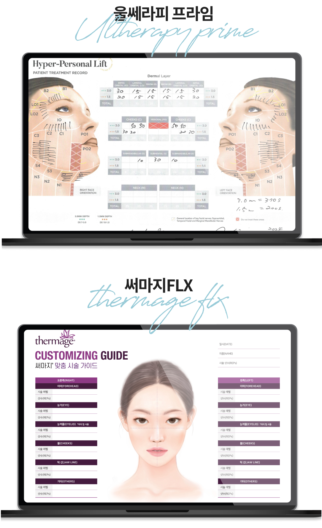 หน้าจอมือถือแสดงขั้นตอนการออกแบบ Custom Chart วิเคราะห์ความหนาของผิวและบริเวณที่ทำหัตถการของแต่ละบุคคล